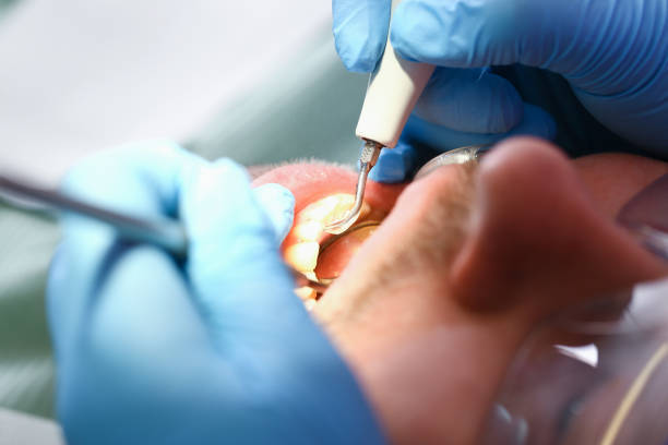 Best Emergency Treatment for Toothache in Caseyvle, IL
